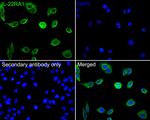 IL-22 Receptor alpha Antibody in Immunocytochemistry (ICC/IF)