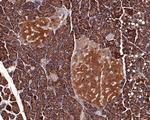 IL-22 Receptor alpha Antibody in Immunohistochemistry (Paraffin) (IHC (P))