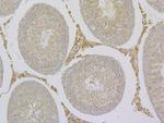 TRPV6 Antibody in Immunohistochemistry (Paraffin) (IHC (P))