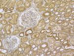 TRPV6 Antibody in Immunohistochemistry (Paraffin) (IHC (P))