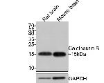 Calcineurin B Antibody in Western Blot (WB)