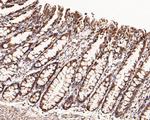 BTRC Antibody in Immunohistochemistry (Paraffin) (IHC (P))