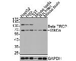 BTRC Antibody in Western Blot (WB)