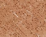 PSMC6 Antibody in Immunohistochemistry (Paraffin) (IHC (P))