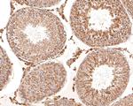 TIMM23 Antibody in Immunohistochemistry (Paraffin) (IHC (P))