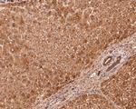 LIGHT Antibody in Immunohistochemistry (Paraffin) (IHC (P))