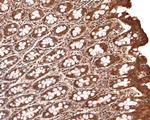 LIGHT Antibody in Immunohistochemistry (Paraffin) (IHC (P))