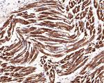 IL-6 Receptor Antibody in Immunohistochemistry (Paraffin) (IHC (P))