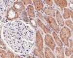 GLI1 Antibody in Immunohistochemistry (Paraffin) (IHC (P))