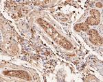 GLI1 Antibody in Immunohistochemistry (Paraffin) (IHC (P))