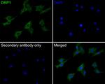 DNM1L Antibody in Immunocytochemistry (ICC/IF)