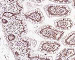 KDM6A Antibody in Immunohistochemistry (Paraffin) (IHC (P))