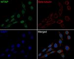 WTAP Antibody in Immunocytochemistry (ICC/IF)