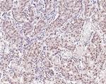 WTAP Antibody in Immunohistochemistry (Paraffin) (IHC (P))