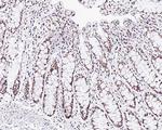 WTAP Antibody in Immunohistochemistry (Paraffin) (IHC (P))