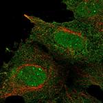 RALBP1 Antibody in Immunocytochemistry (ICC/IF)