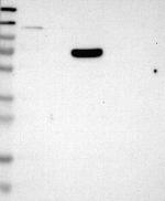 B3GALNT2 Antibody in Western Blot (WB)