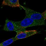 TEM5 Antibody in Immunocytochemistry (ICC/IF)