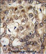 HIPK2 Antibody in Immunohistochemistry (Paraffin) (IHC (P))