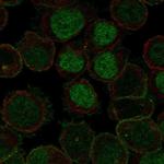 ROBO2 Antibody in Immunocytochemistry (ICC/IF)