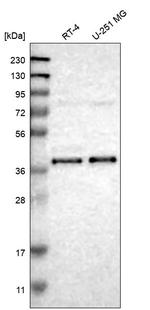 NDRG4 Antibody in Western Blot (WB)