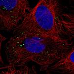 VPS25 Antibody in Immunocytochemistry (ICC/IF)