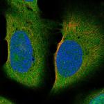 TEKT3 Antibody in Immunocytochemistry (ICC/IF)