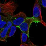 IL11RA Antibody in Immunocytochemistry (ICC/IF)