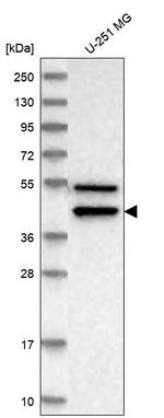 IL11RA Antibody in Western Blot (WB)