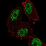 MED26 Antibody in Immunocytochemistry (ICC/IF)