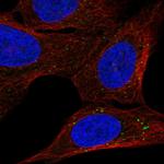 BBS2 Antibody in Immunocytochemistry (ICC/IF)