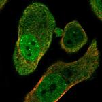 PARG Antibody in Immunocytochemistry (ICC/IF)