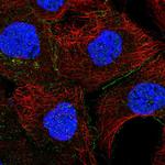 EPS8 Antibody in Immunocytochemistry (ICC/IF)