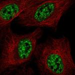 RBMY1F Antibody in Immunocytochemistry (ICC/IF)