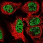 BAZ1B Antibody in Immunocytochemistry (ICC/IF)