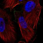 PPAP2C Antibody in Immunocytochemistry (ICC/IF)