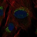 TNFRSF11B Antibody in Immunocytochemistry (ICC/IF)