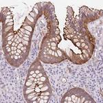 DIXDC1 Antibody in Immunohistochemistry (Paraffin) (IHC (P))