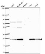 PRDX3 Antibody in Western Blot (WB)