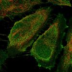 CD83 Antibody in Immunocytochemistry (ICC/IF)