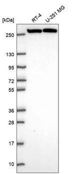 CAD Antibody in Western Blot (WB)