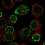 CPNE1 Antibody in Immunocytochemistry (ICC/IF)