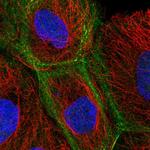 KIF3B Antibody in Immunocytochemistry (ICC/IF)