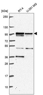 KIF3B Antibody in Western Blot (WB)