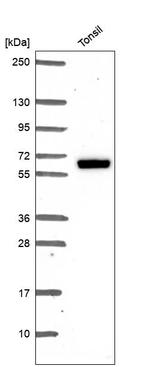 Estrogen Receptor beta Antibody in Western Blot (WB)