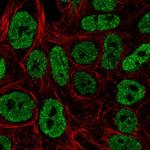 JNK3 Antibody in Immunocytochemistry (ICC/IF)