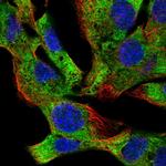 EIF2B4 Antibody in Immunocytochemistry (ICC/IF)