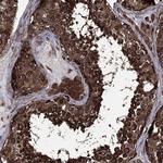 EIF2B4 Antibody in Immunohistochemistry (Paraffin) (IHC (P))