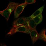 gamma Adaptin Antibody in Immunocytochemistry (ICC/IF)