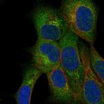 QTRTD1 Antibody in Immunocytochemistry (ICC/IF)